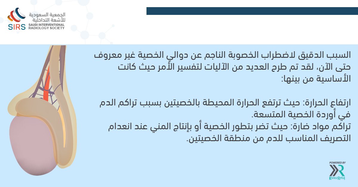أسباب #دوالي_الخصية 

#الجمعية_السعودية_للأشعة_التداخلية
 #الأشعة_التداخلية #بدون_جراحة
#Sirs21ksa