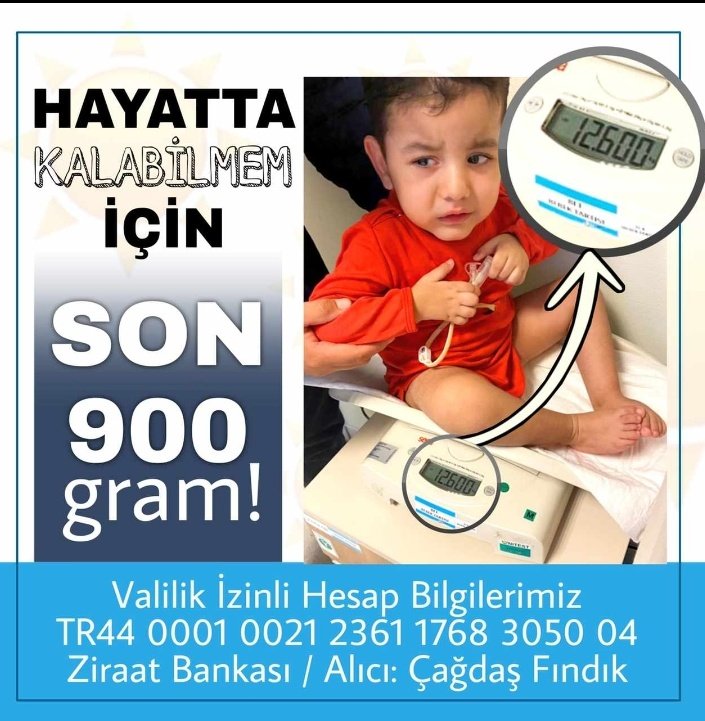 İlacı alabilmemiz için son 900 gram. Lütfen sesimizi duyun.. #asgariücret #altın #asansör