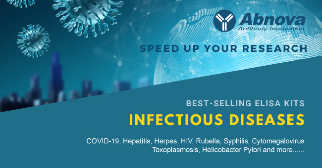 Abnova1's tweet photo. Abnova provides various kinds of infectrious disease ELISA kits to speed up your research.
💠Check out our featured ELISA Kits ➠https://t.co/QfpFtoKdxW 
💠Search your target
➠https://t.co/q90PV9ypTU https://t.co/7kkjc0Ylg8