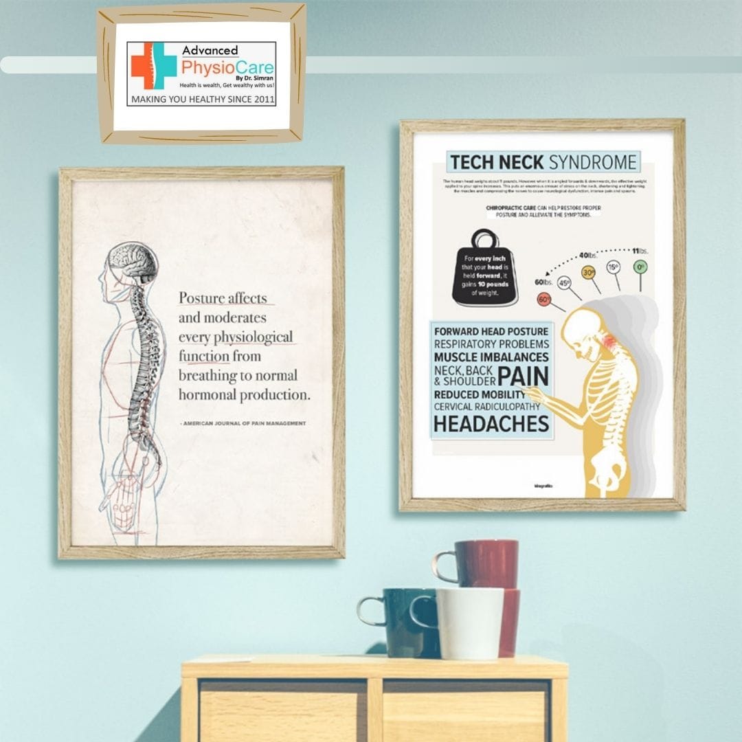 by_drSimran's tweet photo. Team
#advancedphysiocarebydrsimran
#badposturecausestextneck
#physiotherapyinposturalassesment
#physiotherapyinposturecorrection
#physiotherapyintextnecksyndrome
#fightagainstcovid19
#wepromoteprevention 
#getvaccinated 
#wearmask 
#ThisTooShallPass https://t.co/rfiCAYwm5g