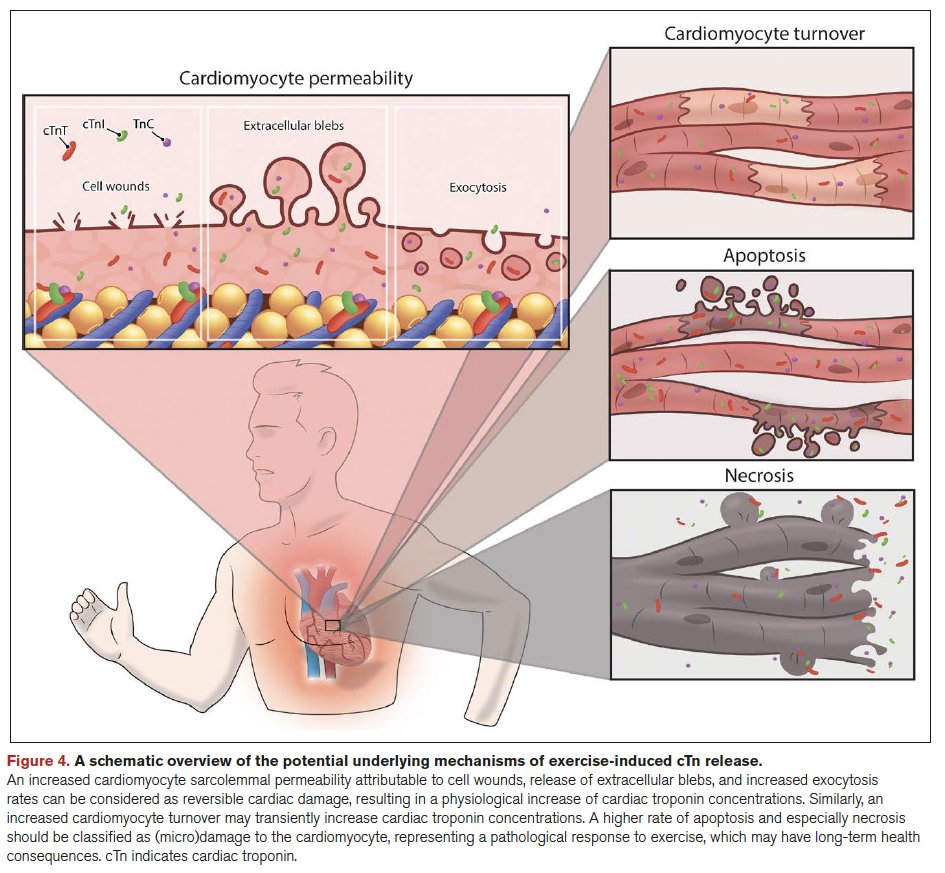 ‼️Hot off the press‼️ Our State-of-the-Art review about #exercise-induced #cardiac #troponin release is now published in @CircAHA: from underlying #mechanisms to #clinical relevance. Open access availability via: ahajournals.org/doi/10.1161/CI…
