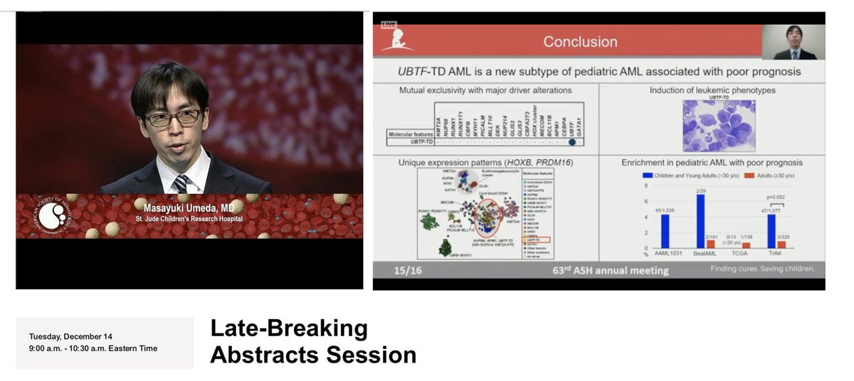 KlcoLab's tweet photo. Masayuki Umeda represented our lab #ASH21 and shared his fascinating collaborative data on UBTF-TD as a new defining subtype of pediatric AML @StJudeResearch @COGorg Great Job! https://t.co/0hvHlWIOde