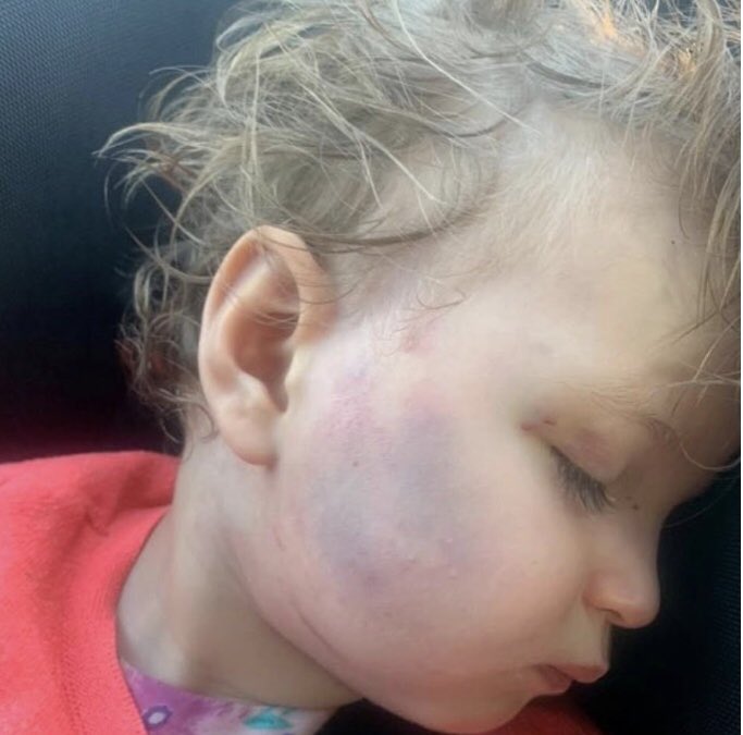 I’m absolutely incensed - someone explain to me how this picture got in the hands of social services and not one person thought this dear little girl was in ‘enough’ danger for anyone to bother getting off their arse!!! Anyone?? 😢💔 #RipStar