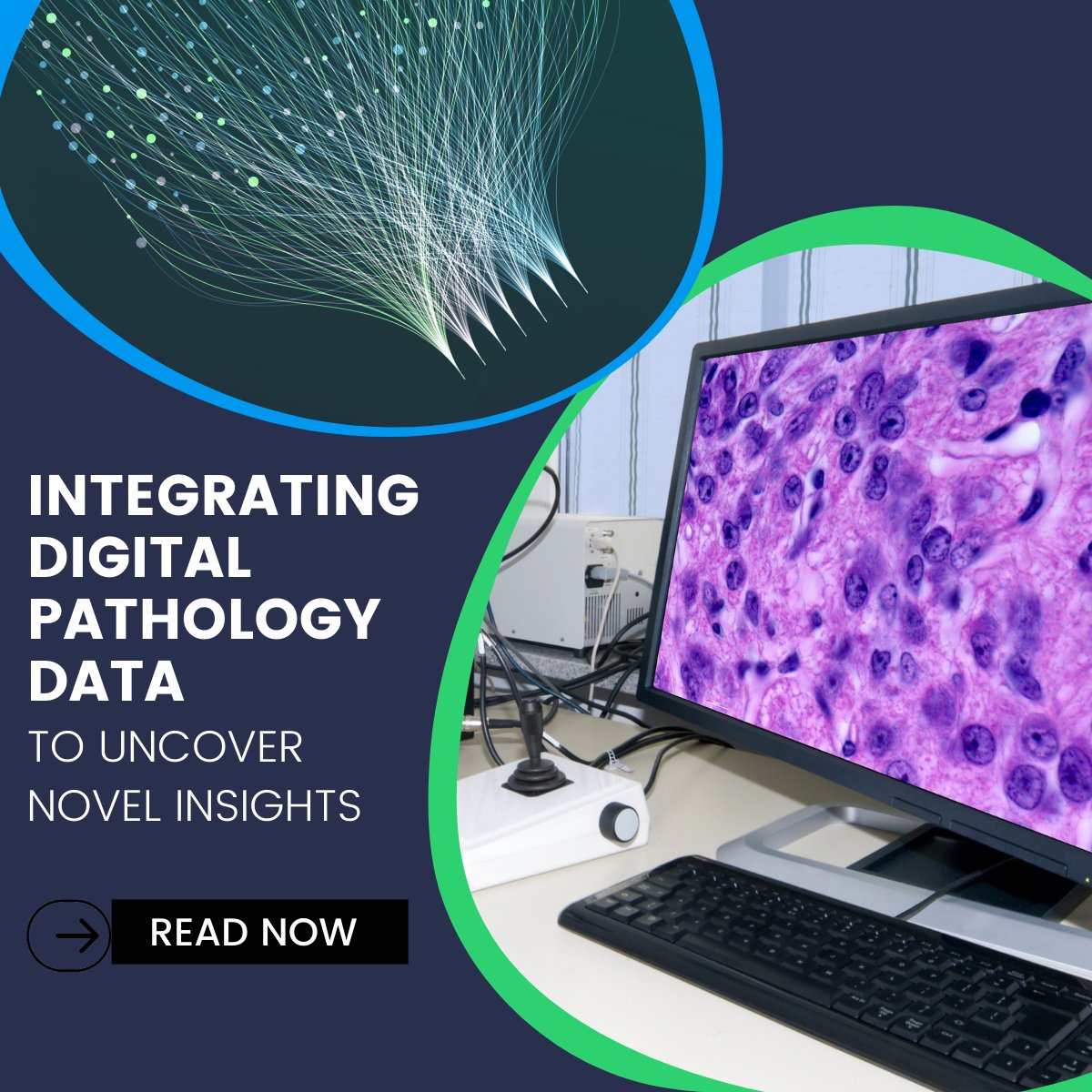 Sonrai's Dr Paul O'Reilly, Head of Innovation, examines the rewards that AI-enabled pathology brings in a research context, particularly in terms of automation, quantification and reproducibility of results. Read: bit.ly/3EfTRI2