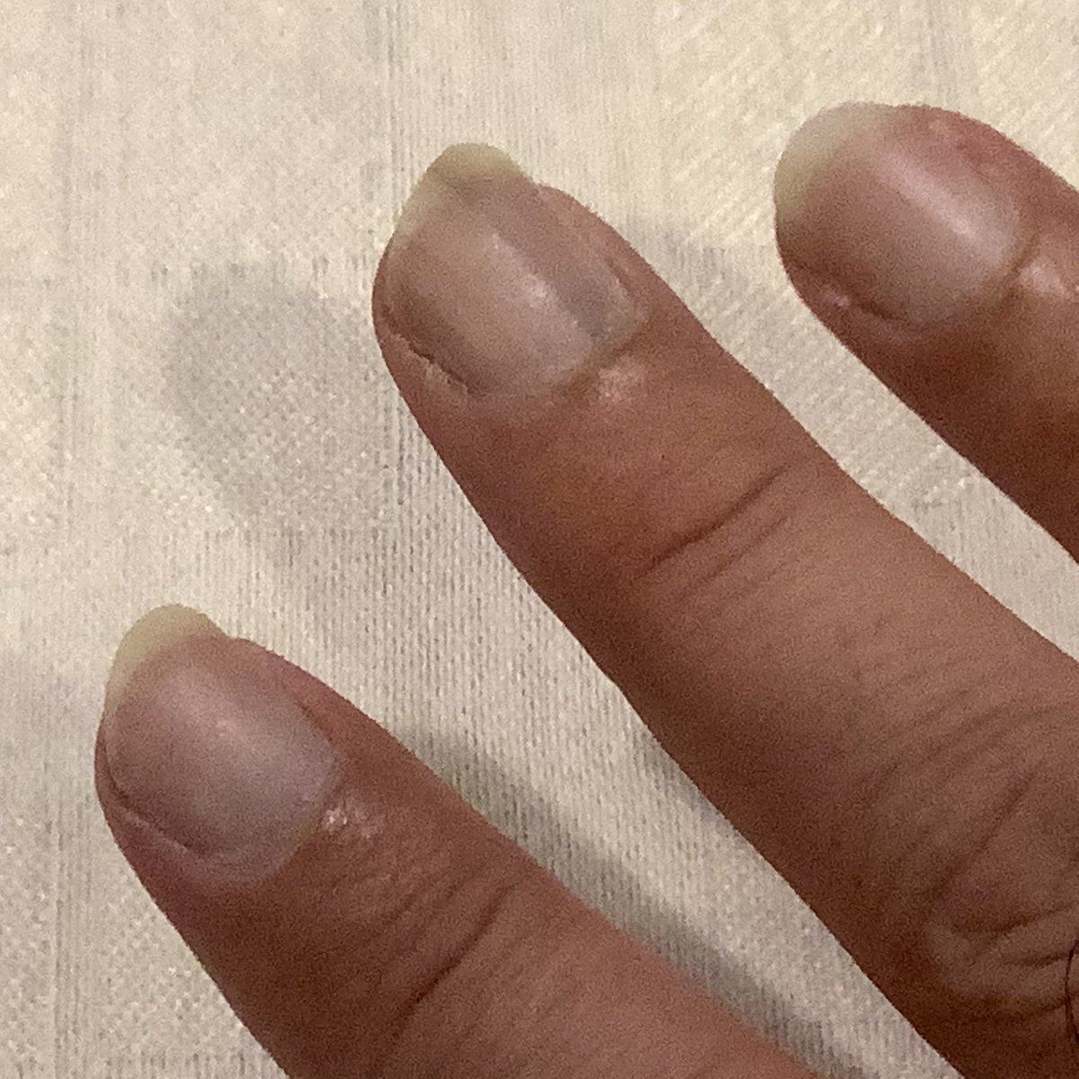 KTM819O4's tweet photo. #ネイルケア #ギターの音質改善 #DrNail #HANDVEIL #RichNail #NailCareCream 
ギター、ウクレレの音は良くなりますが、マニュキュアタイプは爪の違和感が続きました！
一度落として、次回は爪の先端だけ付けてみようと思います！(´∀｀)／ https://t.co/XWN6Skm24S