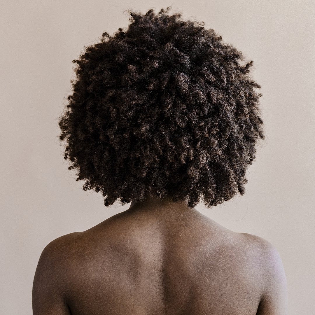 Dermatoloy News | More inflammation found in Black patients with prurigo nodularis
bit.ly/31O88Od
#dermatology  #prurigonodularis #PN #darkerskin #darkskin #johnshopkinsuniversity #Peer2PeerReview #MedicalMagazine #MedicalAestheticMagazine