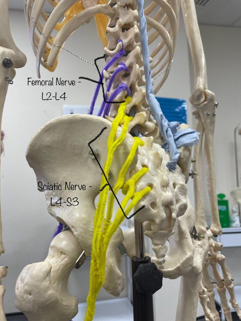 Timo (@timo_ishaku) on Twitter photo Ended this year’s lectures with some creativity from <a href="/CCCUPhysio/">CCCU Physio</a> credit to all year 2 students especially Stacey, Milan and Leah. Ended this year’s lectures with some creativity from <a href="/CCCUPhysio/">CCCU Physio</a> credit to all year 2 students especially Stacey, Milan and Leah.