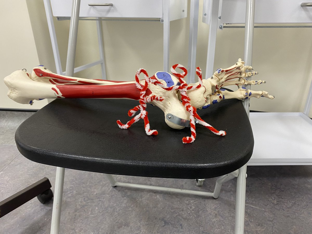 Timo (@timo_ishaku) on Twitter photo Exciting ways to teach applied anatomy credits to all year 2 <a href="/CCCUPhysio/">CCCU Physio</a> especially Stacey, Milan & Leah. Merry Christmas 🎅 and we continue next #LifeofanAcademic Exciting ways to teach applied anatomy credits to all year 2 <a href="/CCCUPhysio/">CCCU Physio</a> especially Stacey, Milan & Leah. Merry Christmas 🎅 and we continue next #LifeofanAcademic