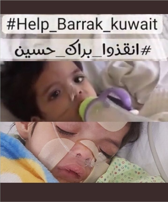 #الطفل_براك_يستنجد_بالعالم
#انقذوا_براك_حسين