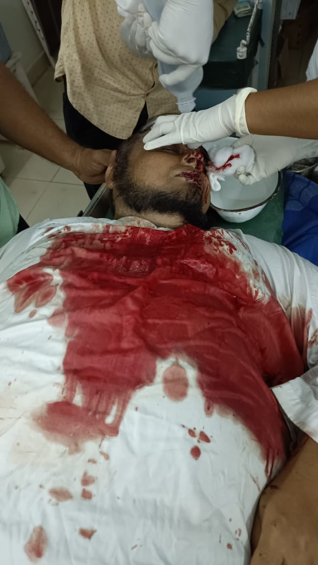 TauheedAhamed_'s tweet photo. More than 50 people severely hit and injured in Uppinangady Lathi Charge.
How dare @spdkpolice use Lathis on peaceful protestors.
It's shame on the part of police who should have been the servants of constitution rather than Sangh Parivar. https://t.co/OTMues9c4T