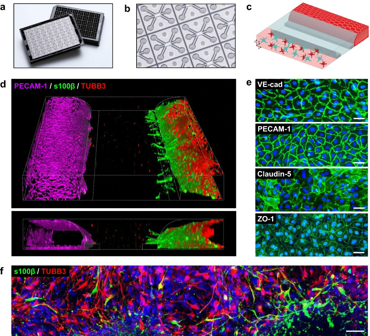 LinvilleRaleigh's tweet image. Modeling ischemic stroke in a triculture neurovascular unit on-a-chip | Fluids and Barriers of the CNS
#stroke #bloodbrainbarrier #labonachip 
fluidsbarrierscns.biomedcentral.com/articles/10.11…