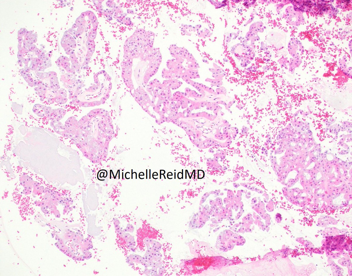 Emory Cytopathology tweet media