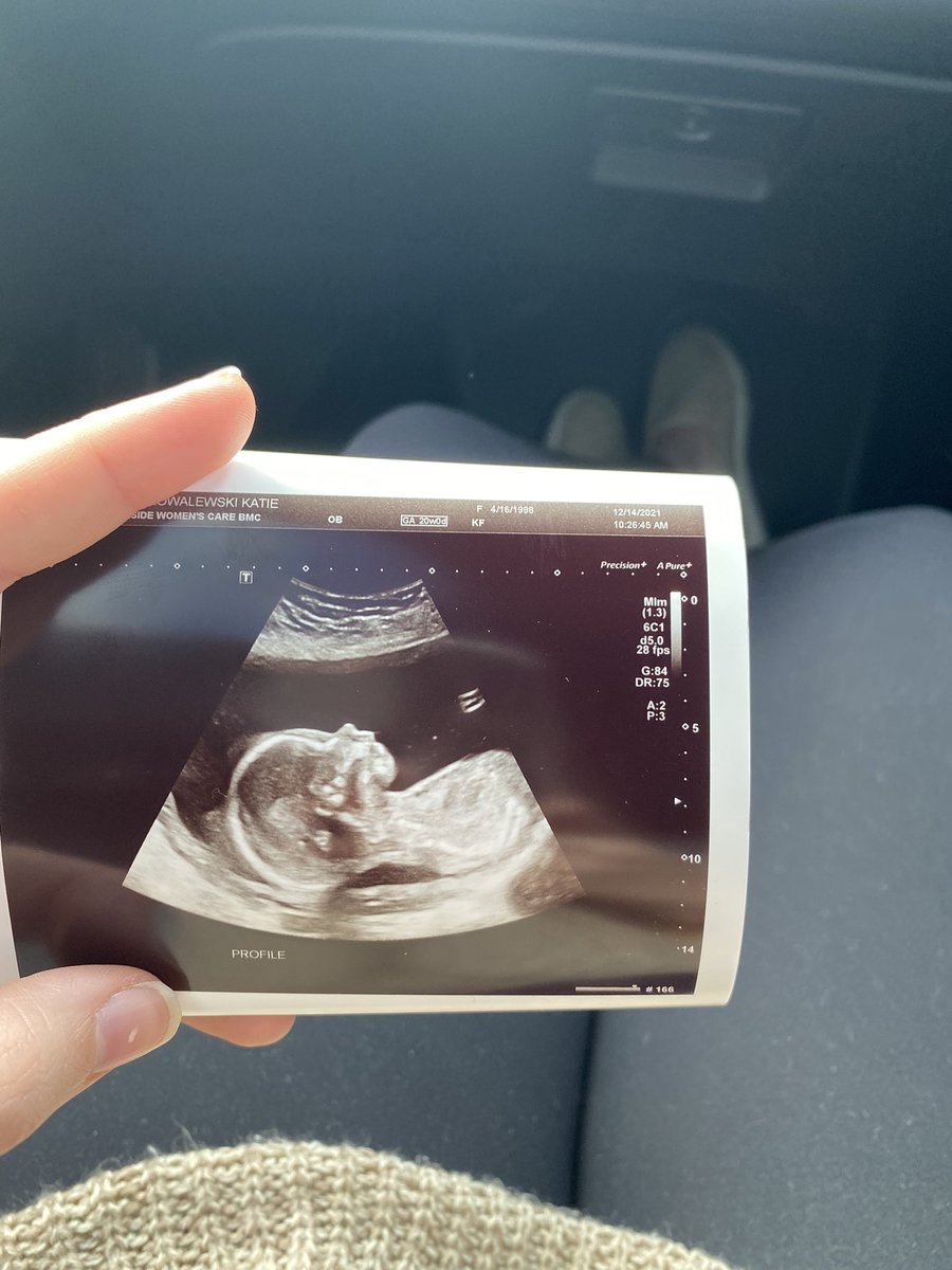 katie_tk98's tweet photo. 20 weeks — halfway there 🤩 https://t.co/9TXnBNuUOf