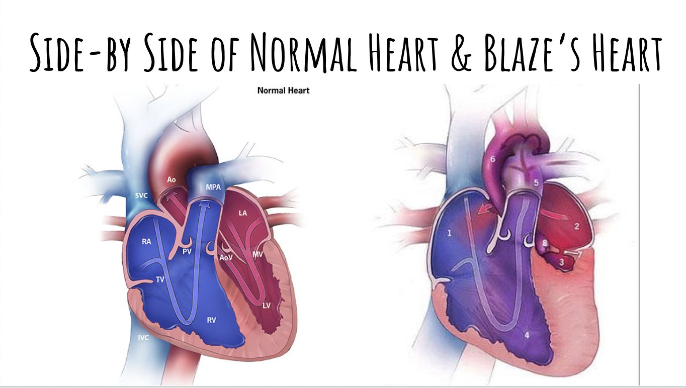Sallie Ortmann on Twitter: "Excited to start our final unit in A&amp;P. We  will be completing a cardiac case study on a child with a congenital heart  defect. Students will analyze the
