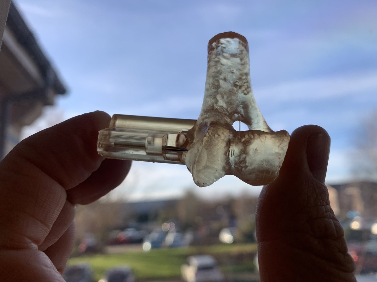 Pop over to Insta to meet Ollie, who travelled a few hundred miles to benefit from custom drilling guides, the HIRS from <a href="/FusionImplants/">Fusion Implants</a> and a good bit of experience…instagram.com/p/CXeXpOpICPY/…