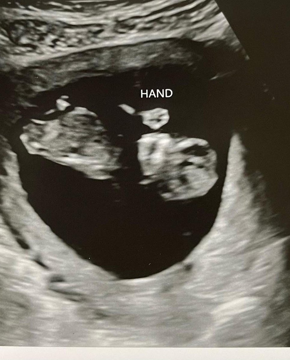 awkkwarddd's tweet image. Can’t wait to hold this little hand in June 2022 😍💗🥺
