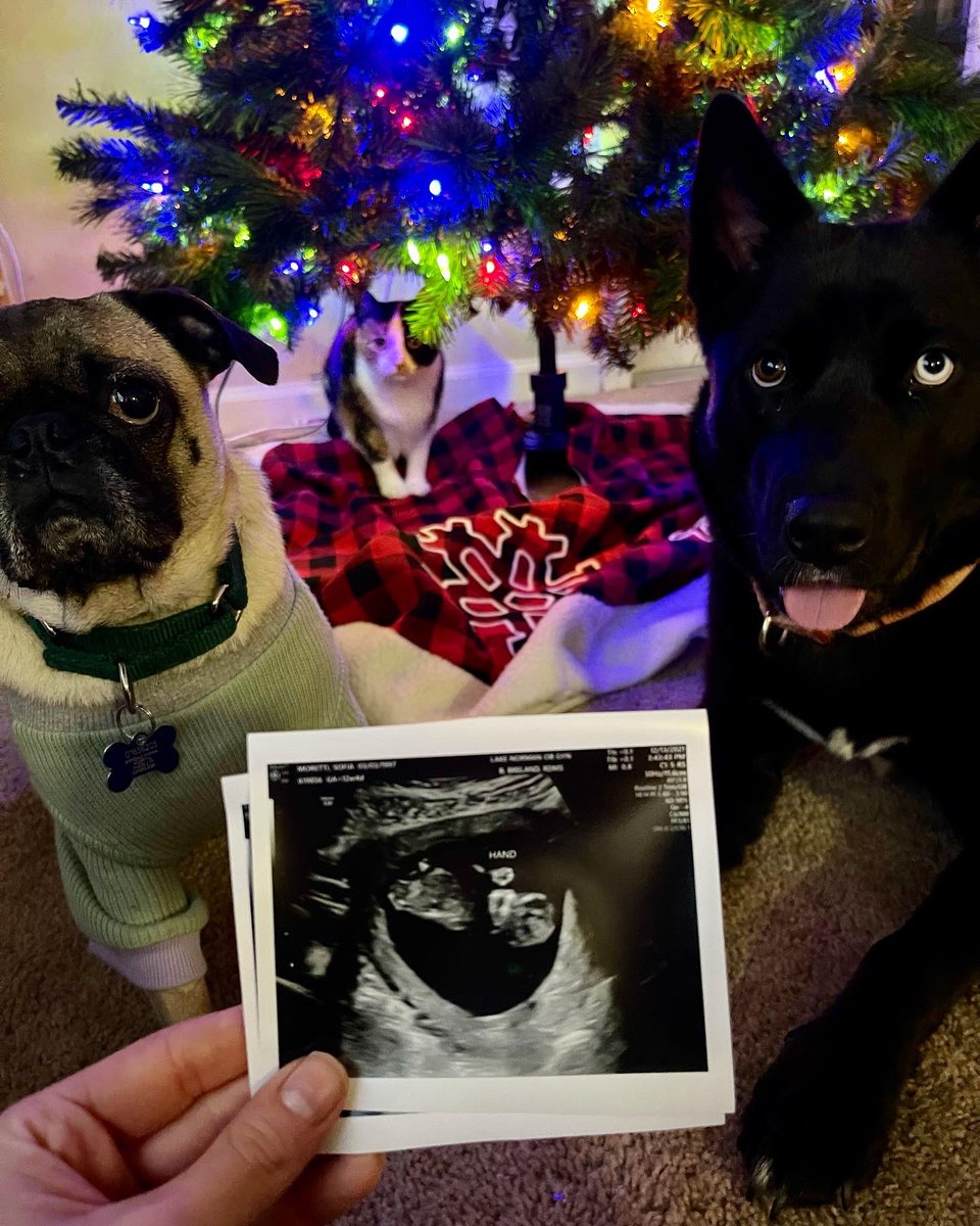 awkkwarddd's tweet image. Can’t wait to hold this little hand in June 2022 😍💗🥺