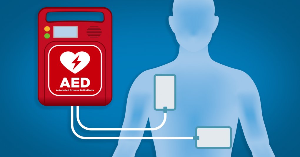 EPSaveALife's tweet photo. Sudden Cardiac Arrest occurs when a heart suddenly &amp; unexpectedly stops pumping blood. It can happen to anyone, at any time.  If SCA does occur, quick use of an automated external defibrillator (AED) can be life-saving and is DESIGNED to be used by regular folks like you and me. https://t.co/j69KrudrQK