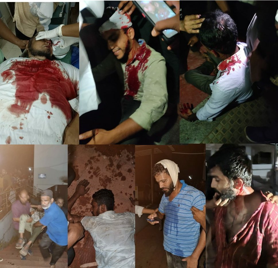 shaikHaneef23's tweet photo. The land of peace has been shattered by the protectors of law. Showing your brutality,Instead of safeguarding the protestors.#Spdkpolice #Gundapolice https://t.co/qqcYvQWWIc
