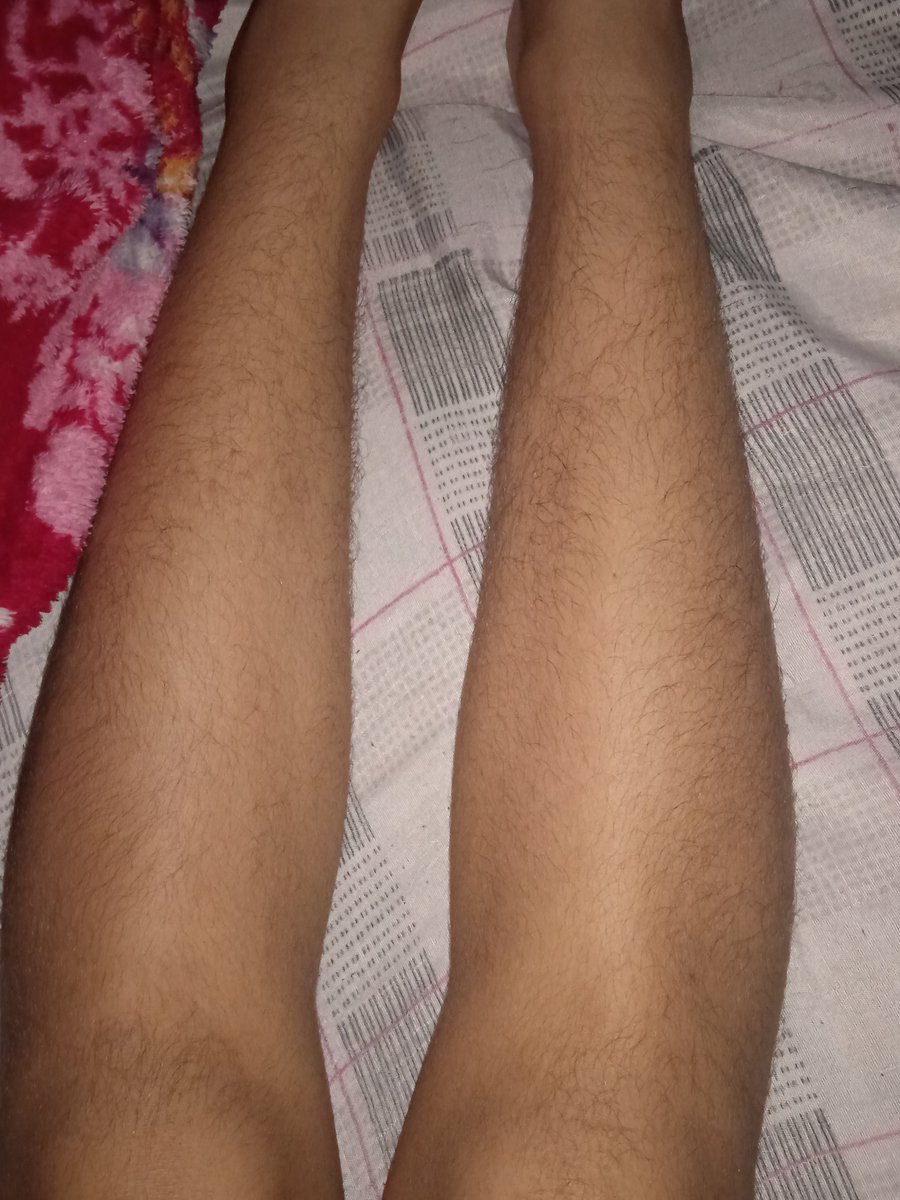 peitolaz's tweet photo. amo mt mt MT meus pelinhos    skz me pedindo doacao d pelo https://t.co/9T8ovKhYqo