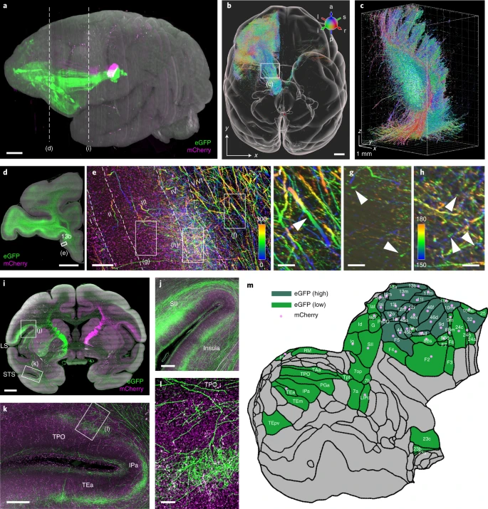 High-throughput mapping of a whole rhesus monkey brain at micrometer resolution.
nature.com/articles/s4158…