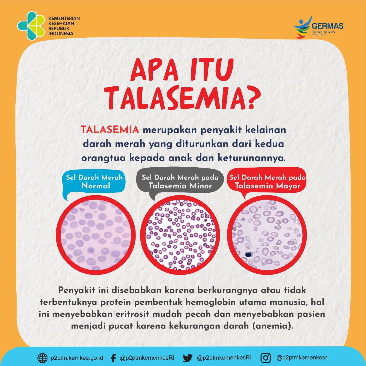 Pembawa talasemia peratus PERSATUAN THALASSAEMIA