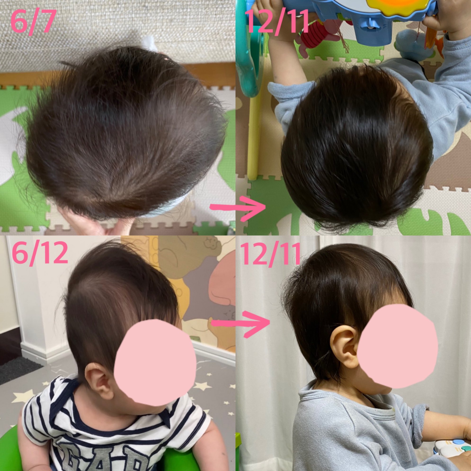 斜頭症 Twitter Search Twitter