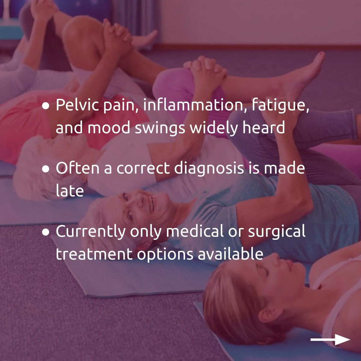 evbasedphysio's tweet photo. Endometriosis is more than pelvic pain. An overview.

This review discusses the latest understanding of endometriosis as a systemic disease with multiple manifestations outside of classic gynaecological disease.

- Lancet 2021: https://t.co/uid0F9y0NF
(Women's Health) https://t.co/NTAgyGmFYY