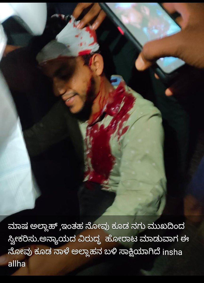 Syedismail6899's tweet photo. Brutal attacks on the Protesters is to stop peoples from rasing the concern against the Oppression!!!
They shouldn't succeed for a better democracy...
#SaveKarnatakaFromGoondaPolice
#MangalorePoliceBrutality
#SanghiPolice https://t.co/OBbPFvTWta