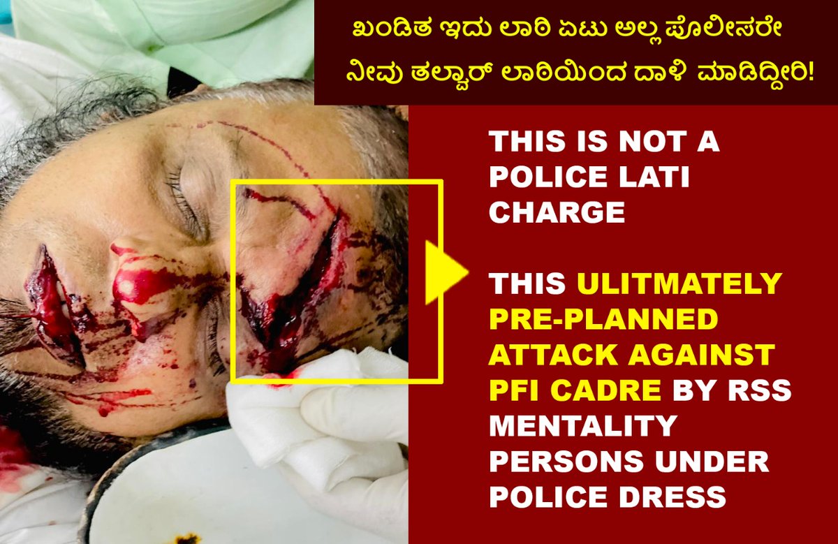AteeqKh23693772's tweet photo. This is your Gujarat model⁉️
Has the trishool distribution programs by VHP Bajarangadal RSS conducted among police station too?  Constitution framed rules for using Lati charge on fellow citizens but mark on prptestors head says police used weapons.
#MangalorePoliceBrutality https://t.co/ZRkuka5oQ3