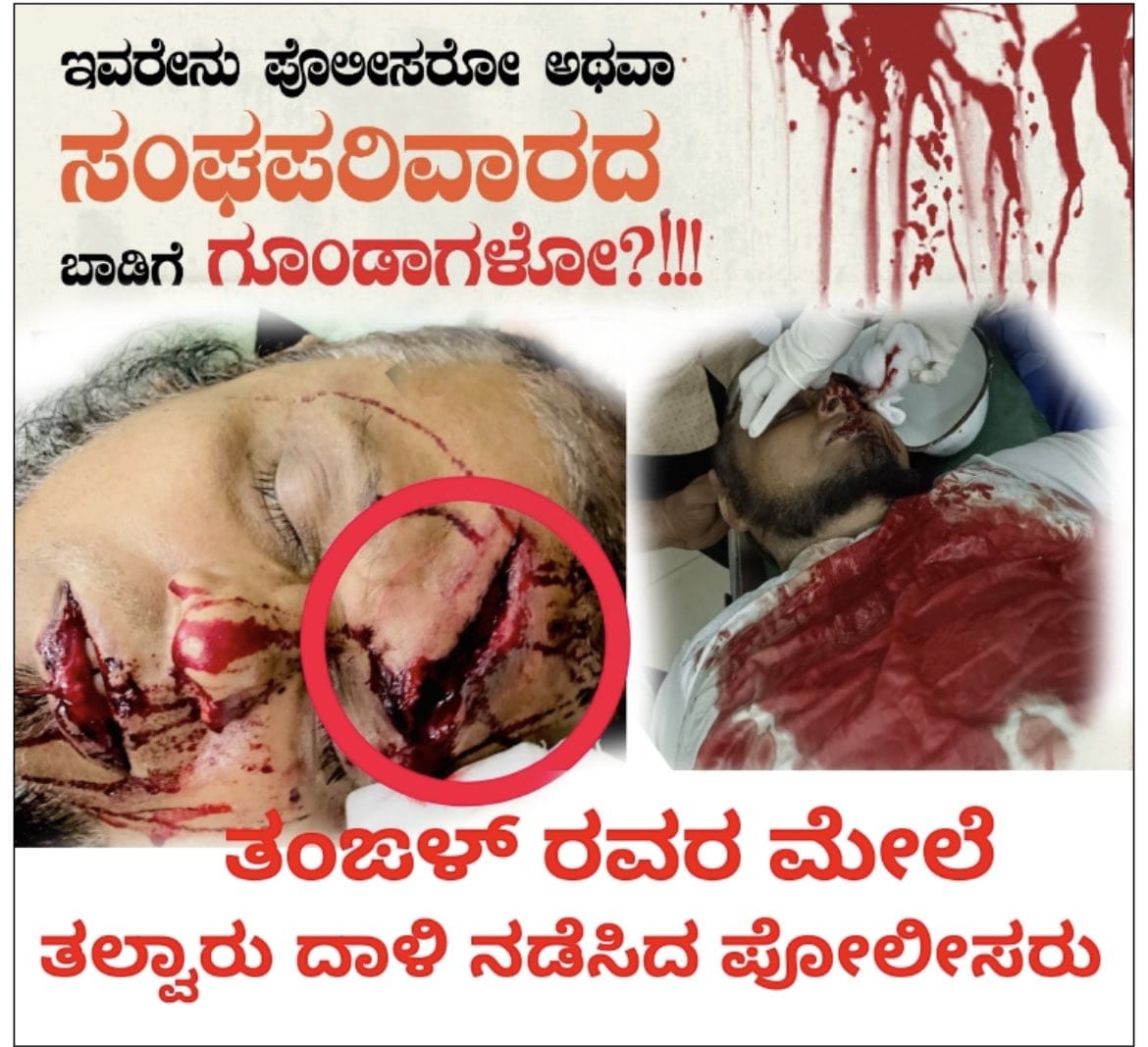 Hussain36322171's tweet photo. As long as senior police officers condone such brutality, sweep such beastly behaviour under the carpet, glossing over unjustified violence as ‘isolated’ incidents, there can be no hope for Justice. 

#MangalorePoliceBrutality https://t.co/nbonluaWdn