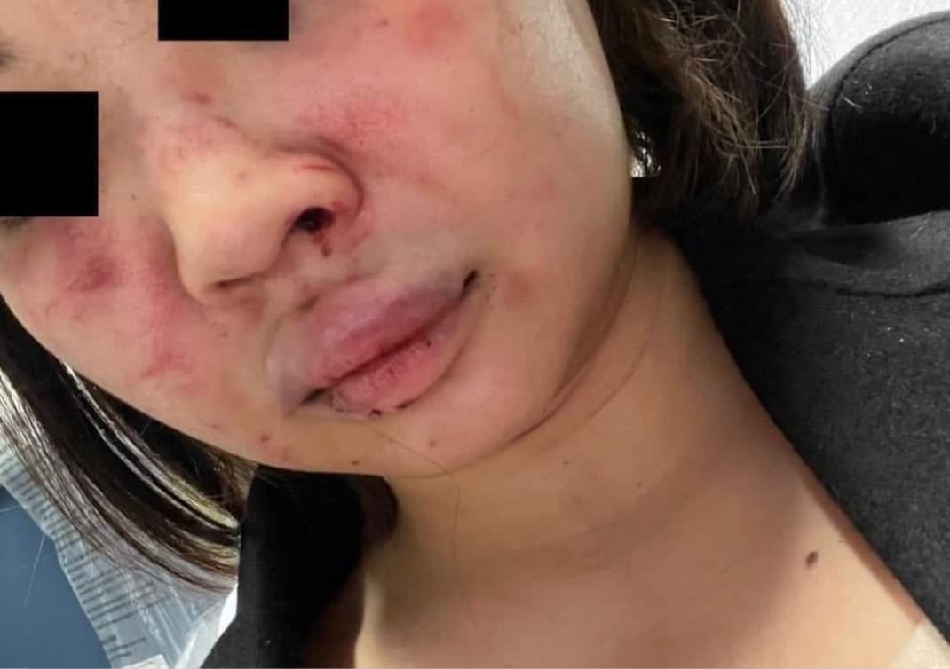 mannnnnu's tweet photo. TW : physical abuse

ฝากรี คนรู้จักเราไปเรียนที่ NY แล้วโดนทำร้ายที่ซับเวย์ 34st โดนจับเหวี่ยง ต่อย ชิงทรัพย์ และพยายามทำอนาจาร แล้วคนร้ายก็หนีไป เบื้องต้นแจ้งความแล้ว แต่ 1 เดือนก็ยังไม่คืบหน้า ญาติเลยอยากให้ช่วยแชร์ต่อให้เป็นข่าวทีครับ จะได้เป็นการกระตุ้นให้ตำรวจเร่งคดีให้ครับ https://t.co/4LvX4mtR1g