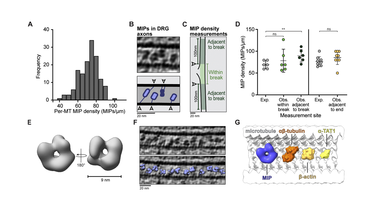Journal of Cell Biology (@jcellbiol) on Twitter photo A cryo-ET survey of #microtubules and intracellular compartments in mammalian axons. A new study from <a href="/_Helen_Foster_/">Helen Foster</a>, @CamillaVenturaS and <a href="/Carter_Lab/">Carter Lab</a>: bit.ly/3pAxO8U
#Cytoskeleton #StructuralBiology #Neuroscience #Organelles A cryo-ET survey of #microtubules and intracellular compartments in mammalian axons. A new study from <a href="/_Helen_Foster_/">Helen Foster</a>, @CamillaVenturaS and <a href="/Carter_Lab/">Carter Lab</a>: bit.ly/3pAxO8U
#Cytoskeleton #StructuralBiology #Neuroscience #Organelles