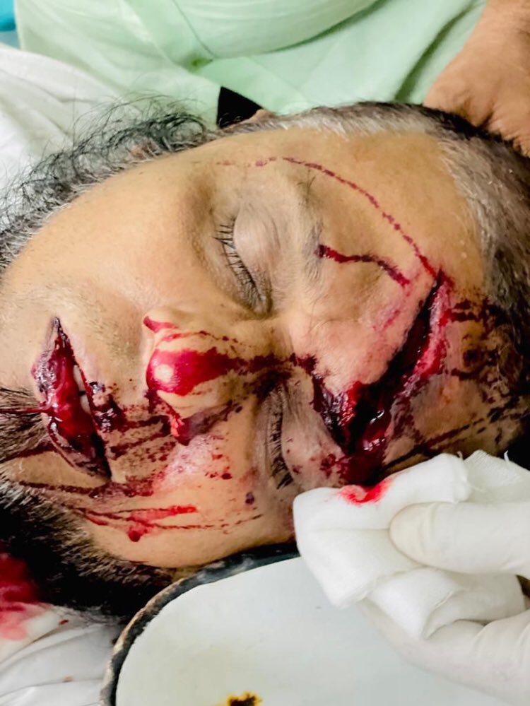 Ansar_Sheikmale's tweet photo. Sab Yaad Rakha Jayega, Sab Kuch Yad Rakha Jayega,

Aur Tumhari Laathiyon Aur Goliyon Se,
Jo Hamla Huwe Hain Mere Yaar Sab,
Unki Yaad Mein Dilon Ko Barbaad Rakha Jayega,

Sab yaad rakha jaayega, Sab kuch yaad rakha jaayega..!

#MangalorePoliceBrutality https://t.co/rfnNhWsm7m
