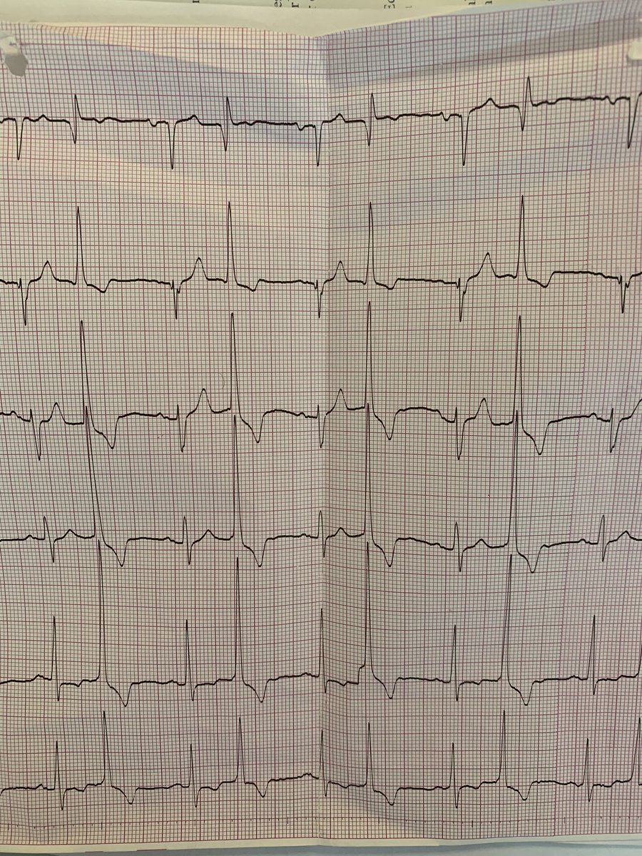 szczasny tweet media