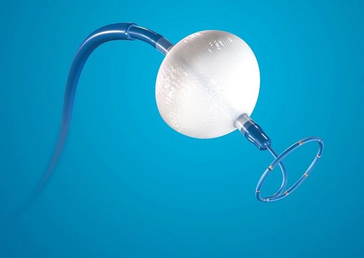 MedicalEAM's tweet photo. Atrial Fibrillation treatment solution by Medtronic.
.
Read more here: https://t.co/FjwwCyjY0N

.
#AtrialFibrillation #AtrialFibrillationtreatment #medtronic #Cryoballooncatheterablation #therapeuticmodalities #IndiaMedtronic #healthcare #healthcaretechnology https://t.co/jQt0fqSEVO
