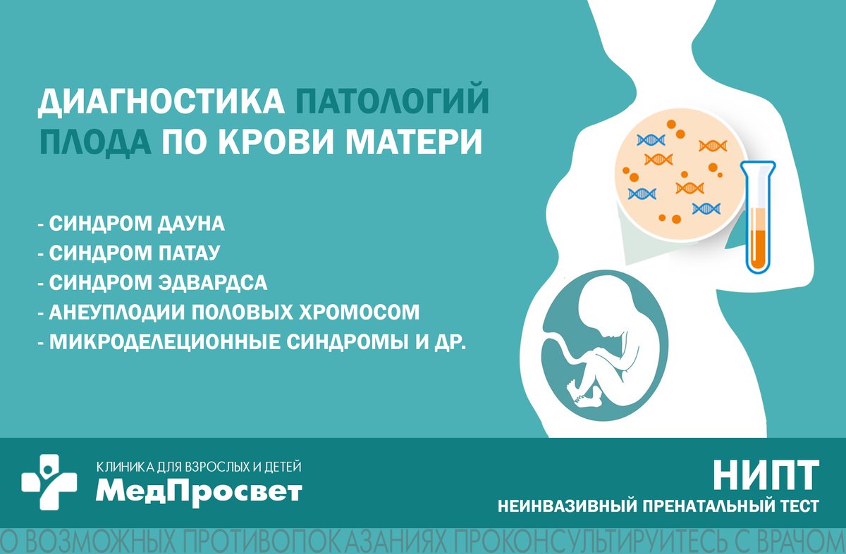 MedProsvet's tweet photo. НИПТ — неинвазивный пренатальный тест на хромосомные аномалии плода, подробнее https://t.co/JEGfeUbnNf

#НИПТ #VERAgene #MGiEASY #патологииплода #синдромДауна #синдромПатау #синдромЭдвардса #клиникаСПб #беременность #СПб #диагностикаприбеременности https://t.co/da2GH5raZ6