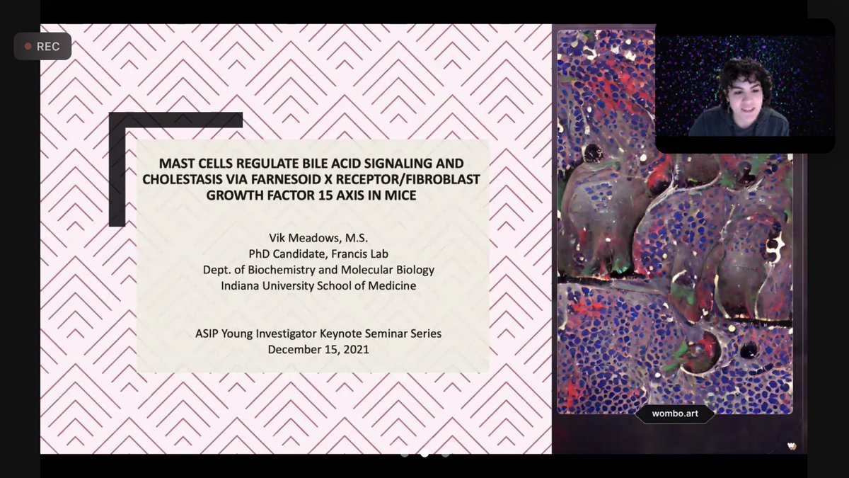 Tuning into today’s @ASIPath Young Investigator Keynote Seminar Series with the amazing @TXevergreengirl who just defended her PhD thesis and is a co-host on @behindourscienc 🥳🥳🥳 #mastcells #bileacidsignaling #liverbiology #ASIPvirtual @chhavic @michelejalves