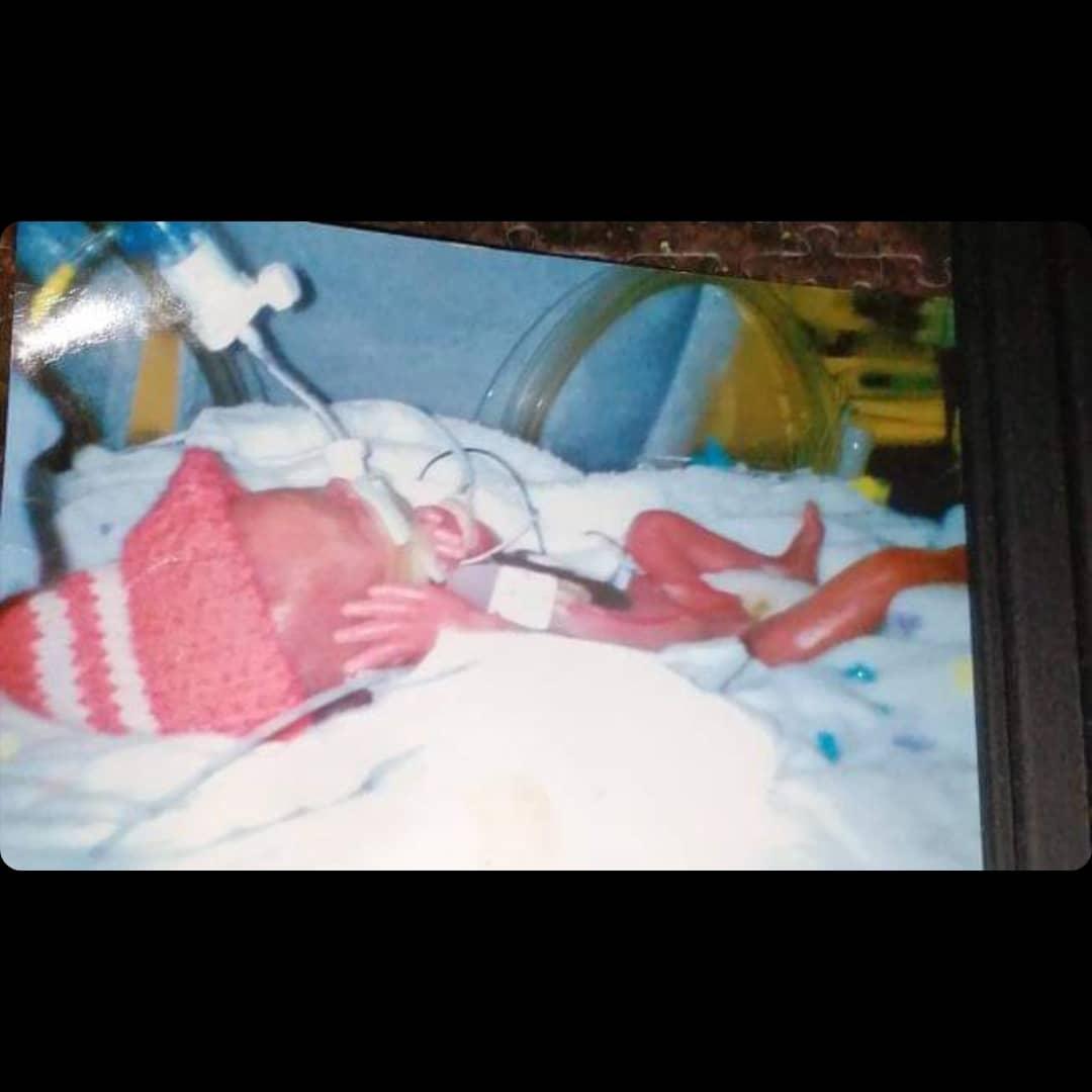 IrishNeonatal's tweet photo. Today we are sharing Sophias preterm birth story on our Fb and Insta pages. Pop over for a read. #WorldPrematurityDay2021 #mypretermbirthstory #ZeroSeparation #23Weeker @EFCNIwecare @GLANCE_Network https://t.co/wOEKARBa13