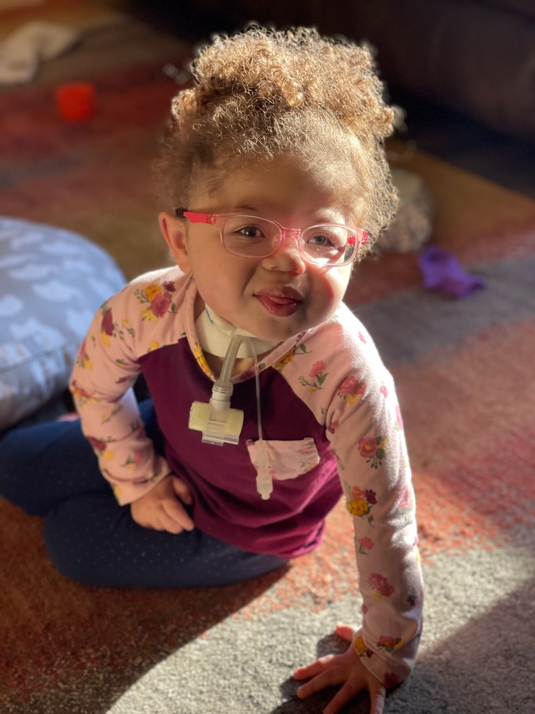 CoulterBME's tweet photo. A 3D-printed tracheal split is providing a breath of hope to 4yo Ramiah Martin and her family. How Scott Hollister collaborated with Penn State Health physician @antsai to treat Ramiah, who was born without a trachea. https://t.co/ETm0iAAaUY https://t.co/NpFxdfJhzN