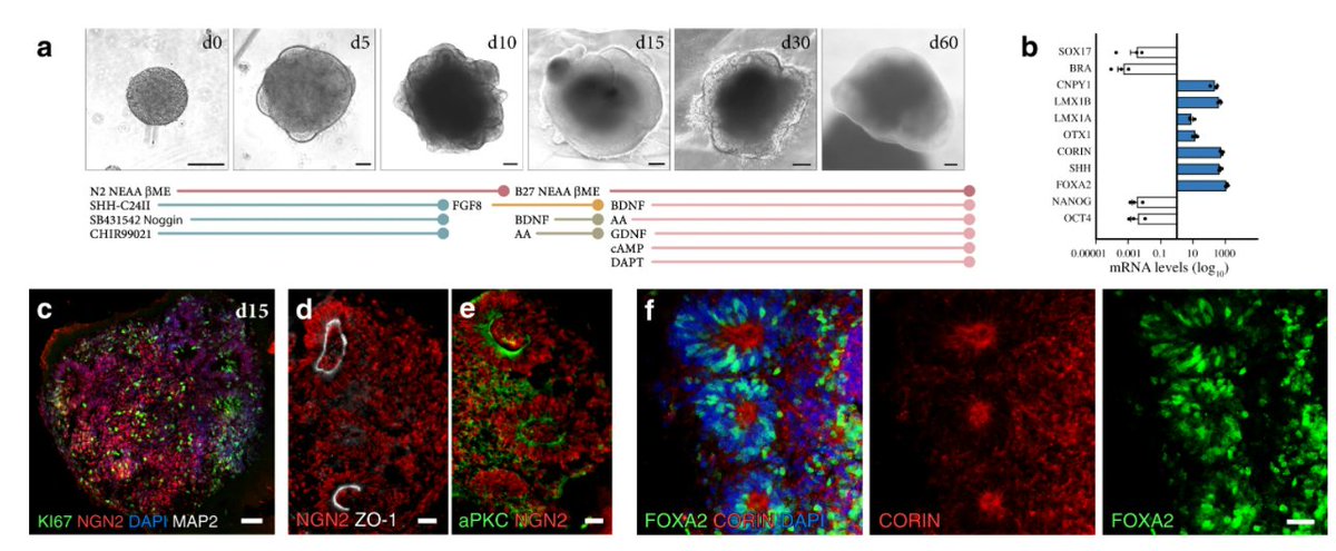 organoidscience's tweet photo. Congrats to the @ParmarLab on their new publication in @NatureComms!

They designed bioengineered ventral midbrain #organoids supported by recombinant spider-silk 🕷️ microfibers functionalized with full-length human laminin.

https://t.co/dWQ5RlM1DJ https://t.co/hkZecce9SZ