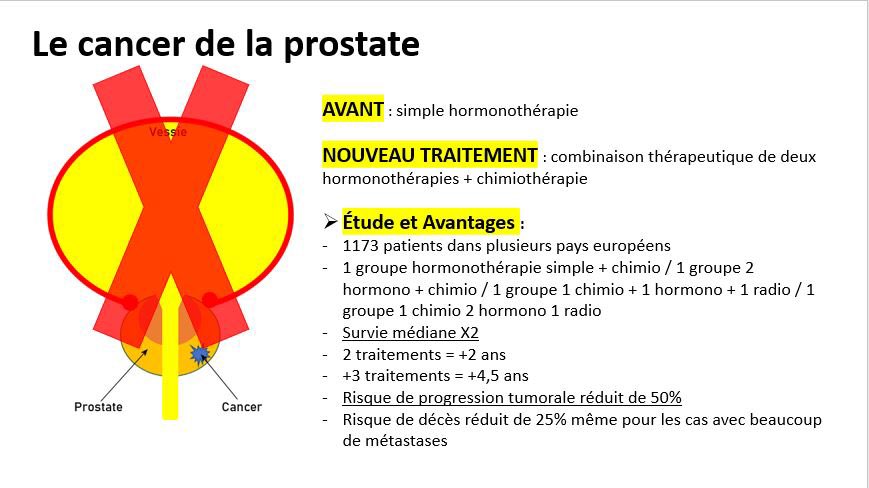 APASsionHandi's tweet photo. Le saviez vous ?
Un nouveau protocole #2021 a permis de doubler le taux de survie pour les cas les + graves de cancer de la prostate ! 
En France, on compte 50000 cancer de la prostate dont 3000 au stade métastatique.
Lien de l’article : https://t.co/0AfIcmRE3u
#L3APASVICHY #ESMO https://t.co/mfyfhu3vAg
