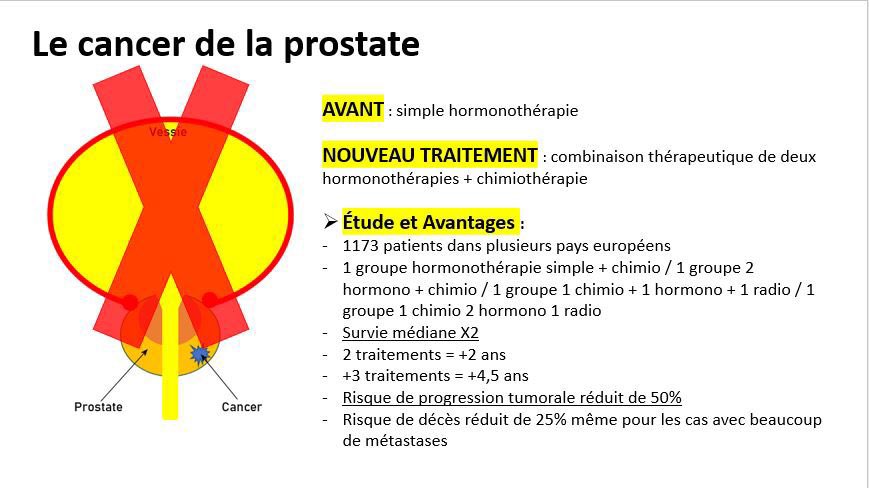 antoine_hbq9's tweet photo. Le saviez vous ?
Un nouveau protocole #2021 a permis de doubler le taux de survie pour les cas les + graves de cancer de la prostate !En France, on compte 50000 cancer de la prostate dont 3000 au stade métastatique.
Lien de l’article : https://t.co/Is7qywJ7KG…
#L3APASVICHY #ESMO https://t.co/pW89YOTM5E
