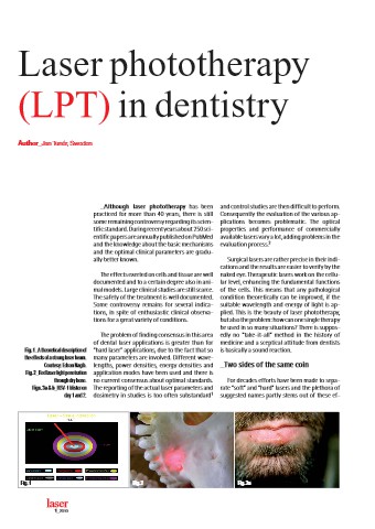 LearnAboutLight's tweet image. Laser Phototherapy in Dentistry bit.ly/2I0imOy

#Neuroplasticity #Photobiomodulation