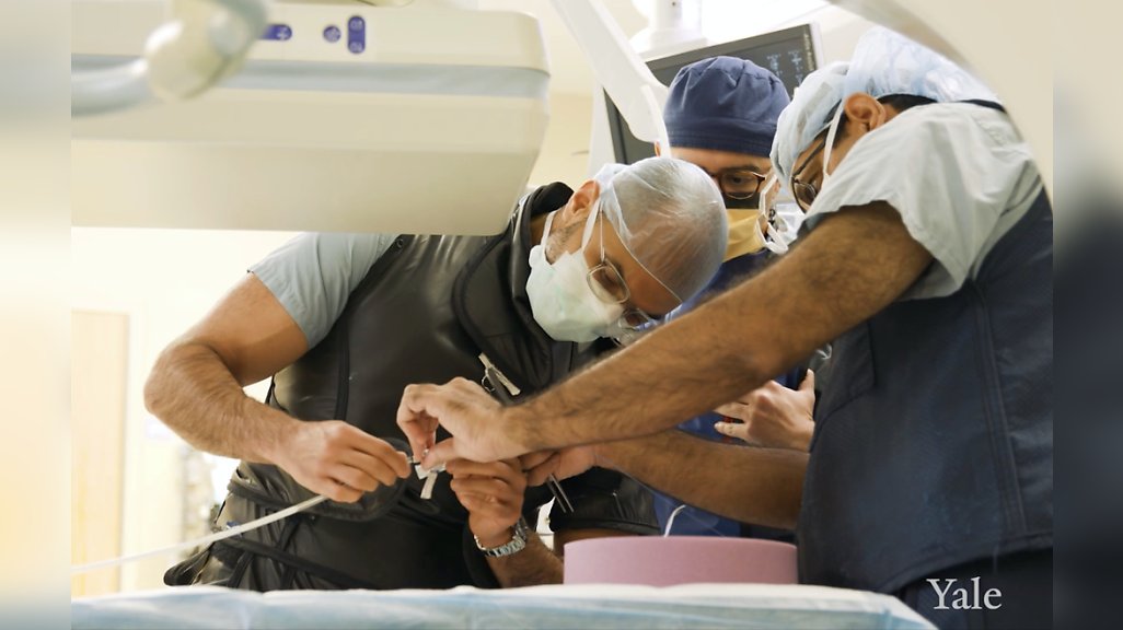 YaleCardiacSurg's tweet photo. A multidisciplinary team approach for the minimally invasive treatment of #thoracoabdominal #aortic pathologies by #branched stent grafts 🫀 A novel approach performed by Dr. @PrashanthVall12 and Dr. Naiem Nassiri https://t.co/dbDEHYUD7j https://t.co/3wGicYRGEx