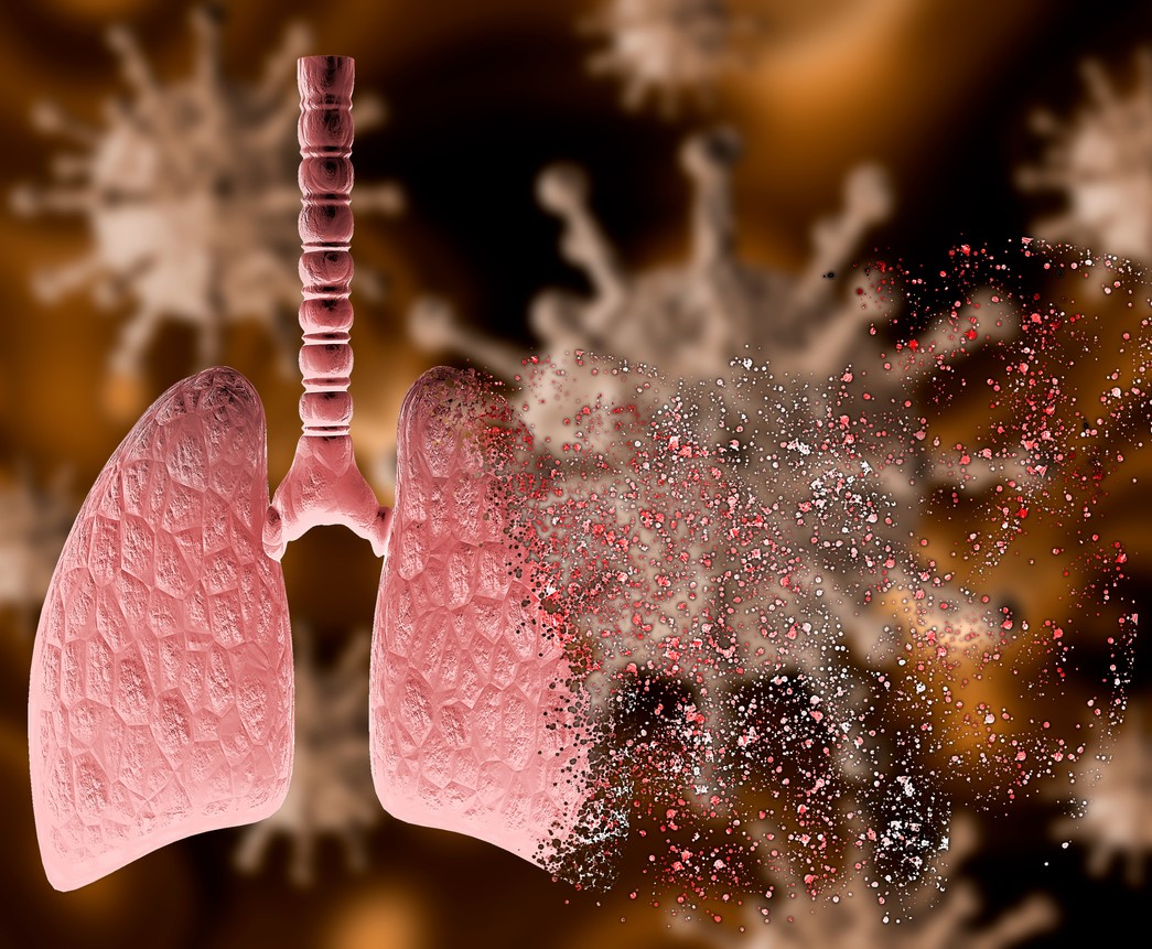 Lung tissue study sheds light on fast Omicron spread

The virus multiplies 70 times faster in the bronchi than the Delta #COVID19 variant and the original SARS-CoV-2, researchers report

ow.ly/3KX050HbNMc