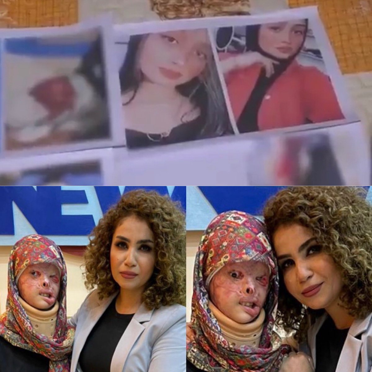 🔴 مـريم مــن بغـــداد
طــــالبة كليــــة فنــــون الجميلـــة
تعـــرضت لأعتــداء وتشـــويه اليـــد
والجســـم بمـــادة " التيزاب "
من قبل شخص فعلـى الجهـات المعنيــة
التحقيـق فــي الامـر والعمــل علـى تطبيـق
القــانون !! و انزال اقصى العقوبات
بحق هذا المجرم.. 
#انقذوا_الاميرة_مريم