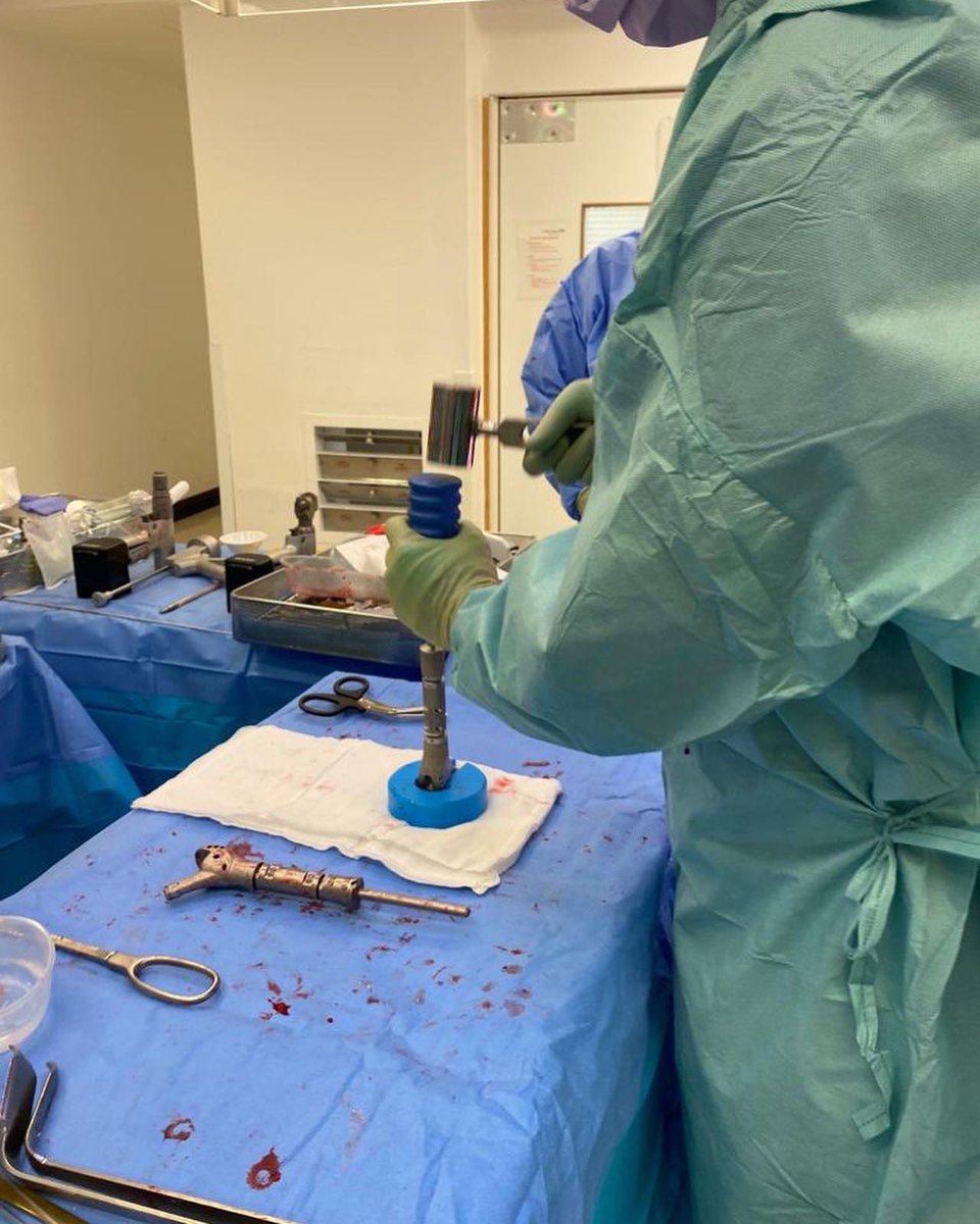 uocuk2's tweet photo. We are delighted to share the first United USTAR II Proximal Femur replacement performed as a second stage revision for infection in the UK and in Europe, successfully implanted by the team at Basingstoke &amp; North Hampshire Hospital! #orthotwitter #ustarII #femur https://t.co/esGwFm3Tuh