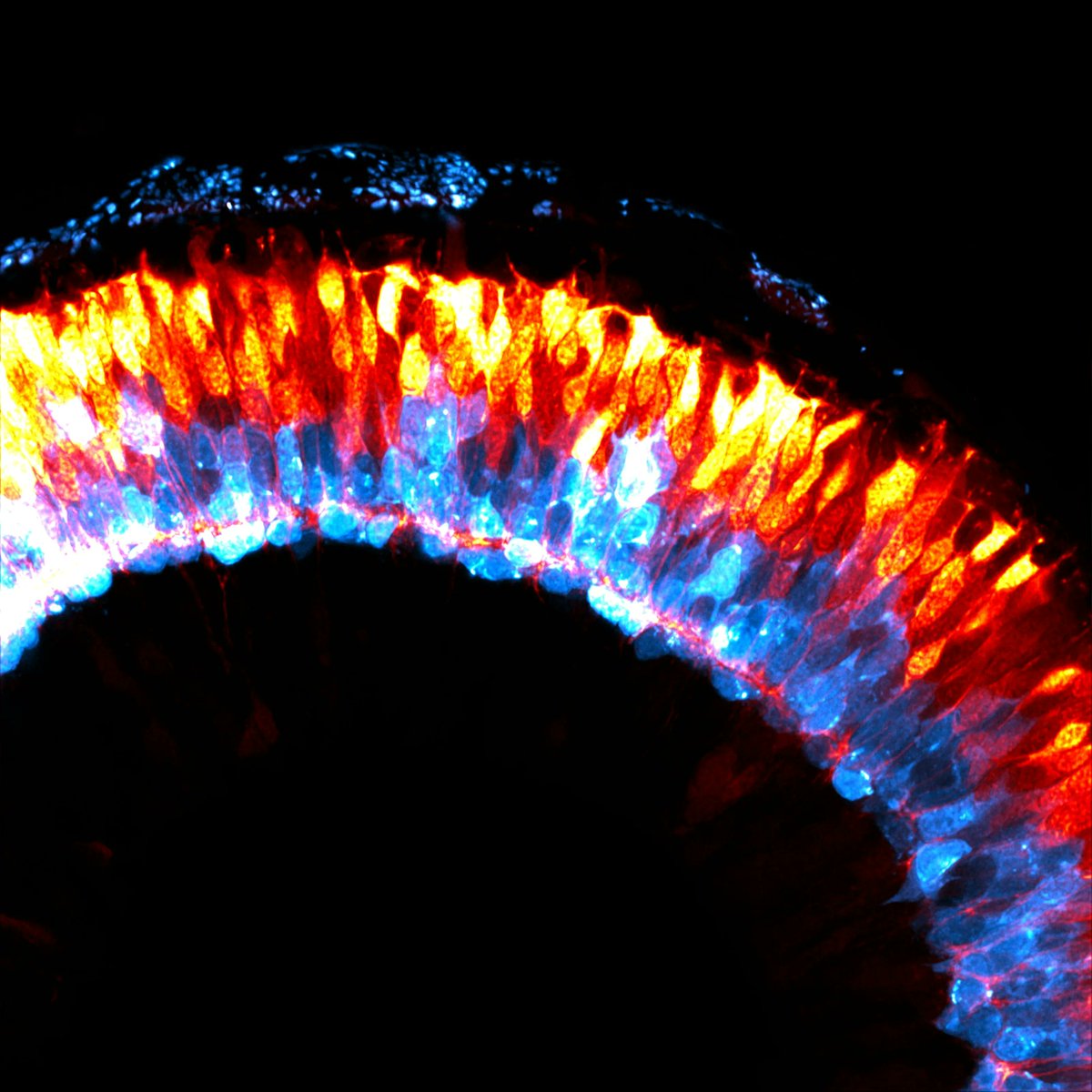 #SciArt advent calendar door #16

Two types of retinal neurons of #zebrafish are shown in red and blue through a microscope. These data help us understand how cells interact and function.
#biomedicalSciences #STEM #vision