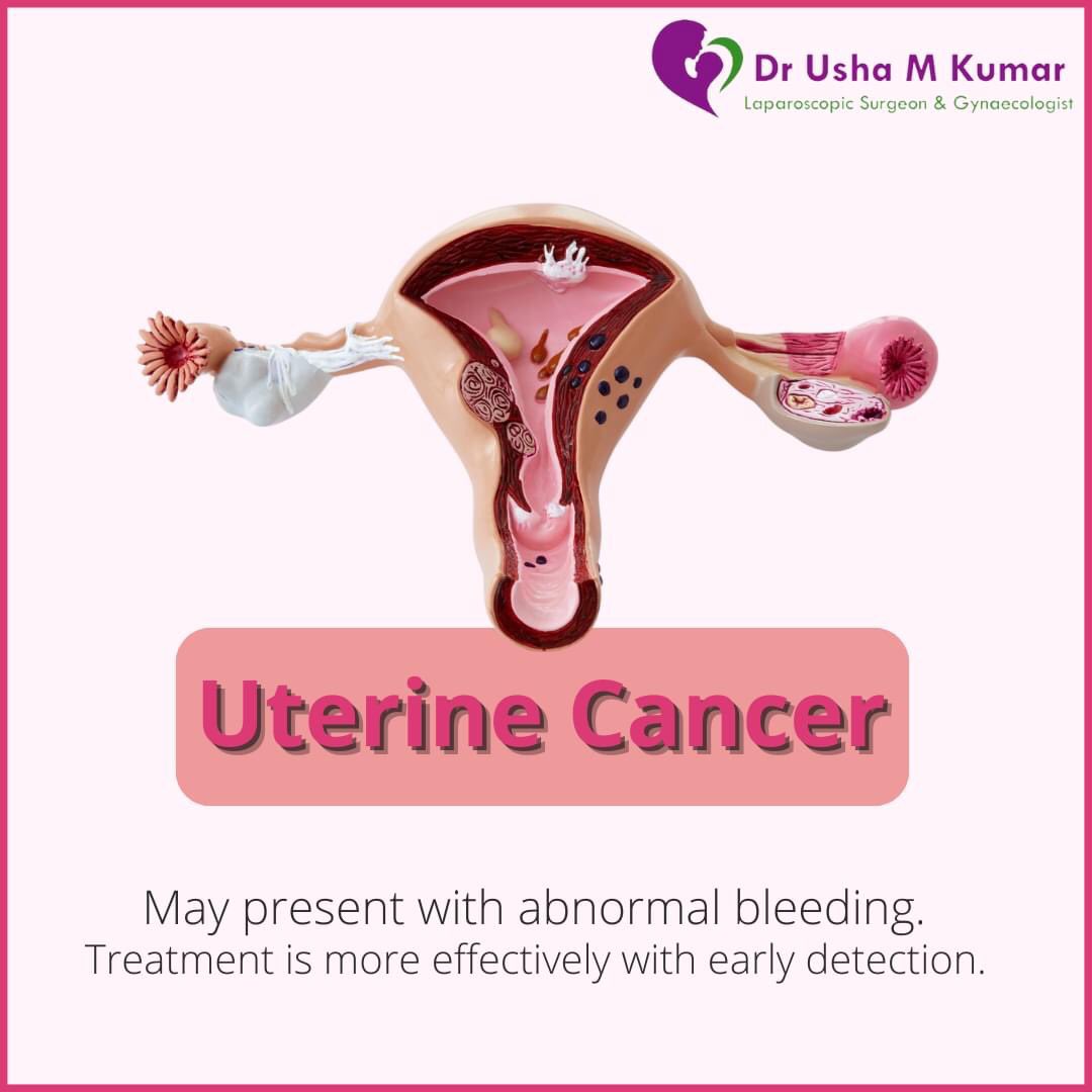 DrUshaMKumar's tweet photo. Endometrial cancer is the most commonly diagnosed gynecologic cancer.

Book an appointment now at +91-9999293741 
Visit: https://t.co/jdheRYX5Wn to know in details.

#Gynecologist #UterineCancer #UterineCancerAwareness #Uterus #UterineFibroid #UterineHealth #WomenHealthcare https://t.co/Ukbc3UY29q